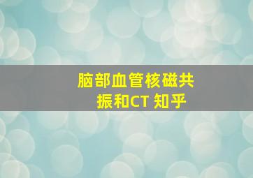 脑部血管核磁共振和CT 知乎